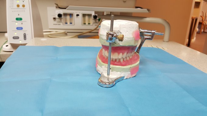 Charakterystyka protez zębowych