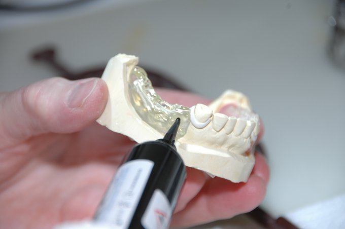 Proteza zębowa